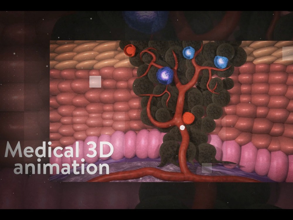 You will get a high-quality 3D medical animation with flexible prices